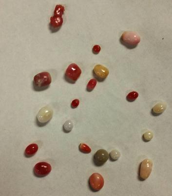 19 Conch Pearls Various Colors & Sizes