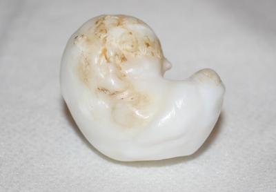 195ct Clam Pearl
