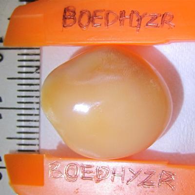 28.8 carats Cassis Cornuta Pearl