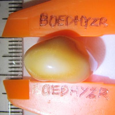 28.8 carats Cassis Cornuta Pearl