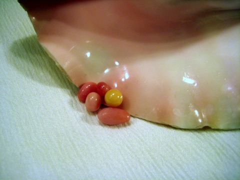 5 Conch Pearls in shell 5 Conch Pearls in shell