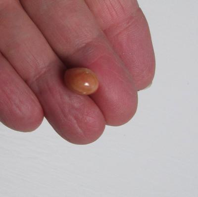 8 carats Conch Pearl Flattish Drop with White Spots