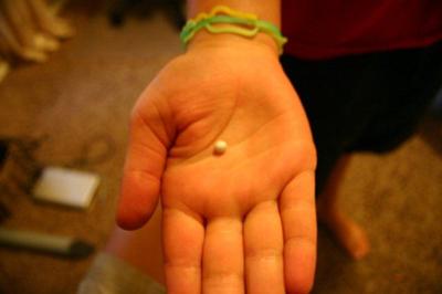 9yr old finds Pearl in Supermarket Oyster!