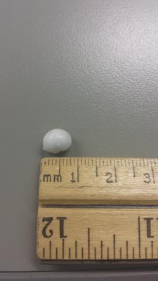 Beautiful pearl found in Louisiana Oyster!