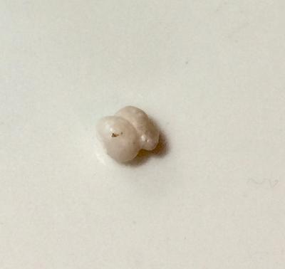 Blue Mussel Saltwater Pearl White Baroque