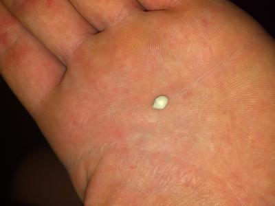 Alabama oyster with pearl