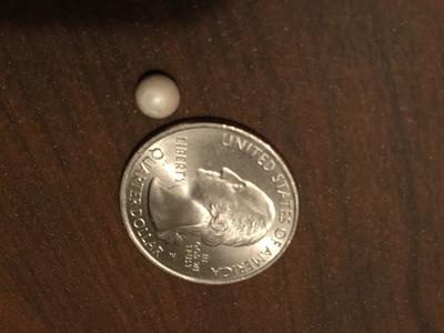 Chesapeake Bay Scallop Pearl?