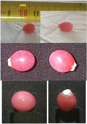 Guadeloupe Conch Pearl