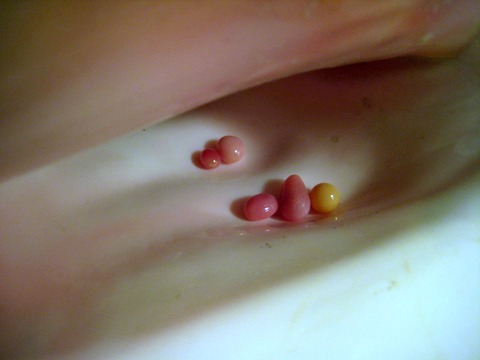 Conch Pearls in shell Conch Pearls in shell