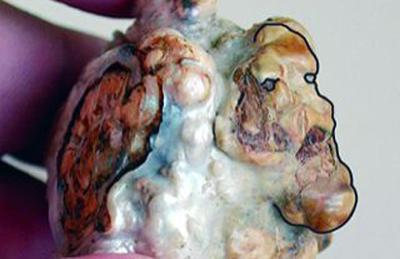 'Divine Miracle' Pearl (photo: http://www.emirates247.com)