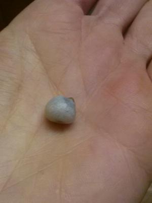 Pearl found in oyster from local seafood market