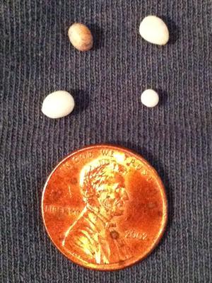 Natural Oyster Pearls