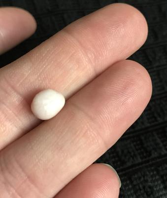 Crab Pearl found in King Crab Claw