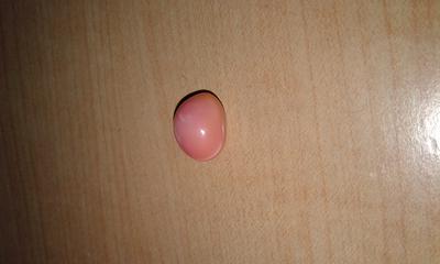 Pink Conch Pearl