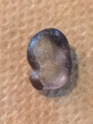 Found pearl while eating oysters with my boyfriend