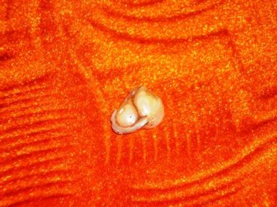 Rare Heart Shaped Pearl