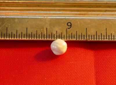 Pearl or Not?  King Crab Pearl