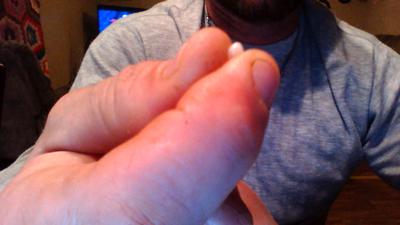 pearl found while eating oyster