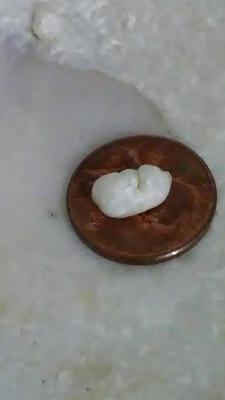 large pearl with a blister in the corner of the shell