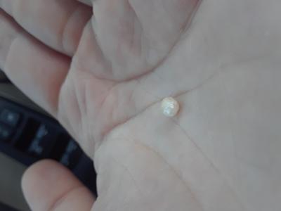  PEARL in a scallop at an Italian restaurant in NJ