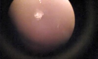 chip under scope at 4x mag