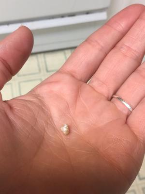 Scallop pearl