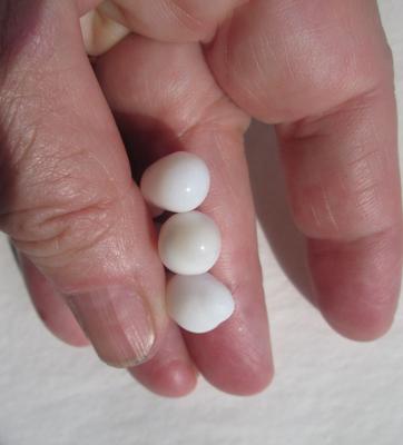 Three Fat Drop Shaped Clam Pearls 34+ carats Total 