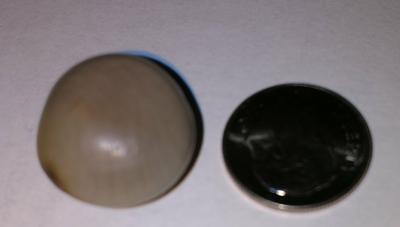 Could this be a quahog pearl?